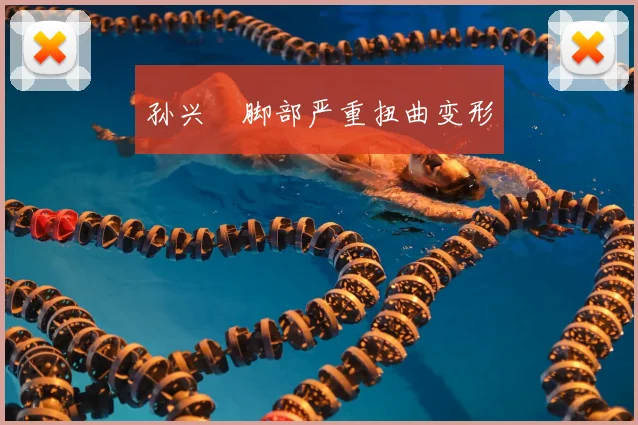 孙兴慜脚部严重扭曲变形